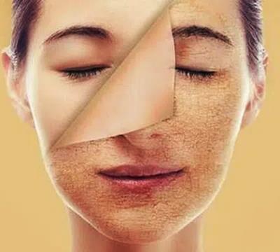 4 món ăn thức uống đẩy nhanh quá trình lão hóa, nếp nhăn 'ghé thăm' nàng rất sớm