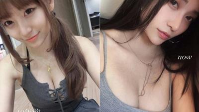 Bị nghi “dao kéo” vòng một suốt nhiều năm, hot girl bất ngờ tung bằng chứng minh oan.