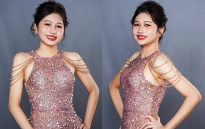 Cô gái hở hàm ếch "lột xác" sau 2 lần mổ tái tạo gương mặt