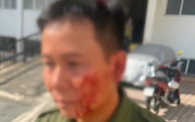 Nam thanh niên cố thủ bằng dao rồi gây thương tích cho lực lượng an ninh